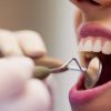 România, țara lui „dinte, gaură, lipsă, pauză”. Colegiul Medicilor Stomatologi cere introducerea „stomatologiei de familie” cu servicii decontate de stat