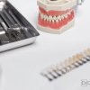Care e varianta optimă: proteză dentară fără implant sau proteză fixă? Vezi despre fiecare în parte