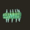 Tehnologia CAD-CAM la Green Dental Lab