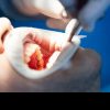 Aproximativ o treime din dinţii pacienţilor români au carii în diferite stadii