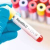 Statistică îngrijorătoare: 5 infecții cu hepatita B și C în fiecare minut în România