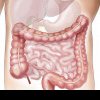 Primele simptome ale cancerului de colon. Semnele care trebuie să te trimită la doctor