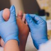 Ciuperca piciorului: cum să recunoști infecția și să o tratezi eficient