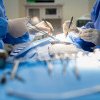 Operație în premieră la Timișoara: stomacul unui pacient a fost transformat într-un tub gastric