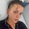 Emily Burghelea, rasă în cap după accidentul din Mauritius. Ce diagnostic a primit!