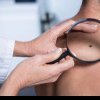 Medic: Cancerul de piele se întâlneşte la vârste mult mai mici, începând cu 30 - 40 de ani