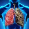 Medic celebru: Poluanţii din aer exacerbează bolile respiratorii şi cardiovasculare