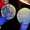 Descoperire medicală importantă: Un nou tip de antibiotic elimină riscul de apariție a superbacteriilor
